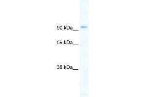 WB Suggested Anti-PIK3CB Antibody Titration:  5ug/ml  Positive Control:  Human brain (PIK3CB anticorps  (C-Term))