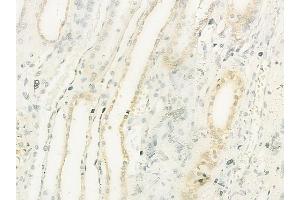 ABIN6260934 and ABIN6273212 at 1/100 staining human normal kidney tissue by IHC-P.
