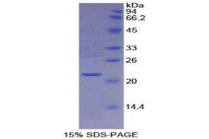 SDS-PAGE (SDS) image for Peroxiredoxin 6 (PRDX6) (AA 1-224) protein (His tag) (ABIN1080508)