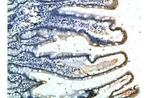 Immunohistochemical analysis of paraffin-embedded human-colon, antibody was diluted at 1:200 (Selectin E/CD62e anticorps)
