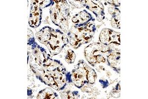 Immunohistochemistry of paraffin embedded human placenta using CCRL2 (ABIN7073461) at dilution of 1:300 (400x lens) (CCRL2 anticorps)
