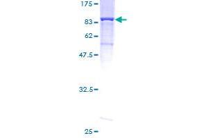 Image no. 1 for Membrane Protein, Palmitoylated 2 (MAGUK P55 Subfamily Member 2) (MPP2) (AA 1-552) protein (GST tag) (ABIN1311218) (MPP2 Protein (AA 1-552) (GST tag))
