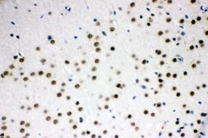IHC analysis of SF2/SRSF1 using anti-SF2/SRSF1 antibody (ABIN3043296). (SRSF1 anticorps  (N-Term))
