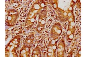 IHC image of nphHU diluted at 1:8 and staining in paraffin-embedded human small intestine tissue performed on a Leica BondTM system.