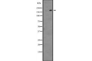 Western blot analysis of PARP4 expression in Hela cell lysate,The lane on the left is treated with the antigen-specific peptide.