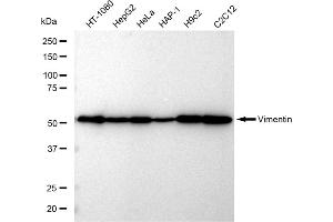 Western blotting analysis using Vimentin antibody (ABIN7800839).