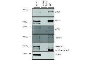 Immunoprecipitation analysis using Mouse Anti-VPS35 Monoclonal Antibody, Clone 8A3 (ABIN6932978).