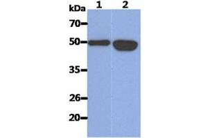The Recombinant Human KRT14 (50ng) and Cell lysates (40ug) were resolved by SDS-PAGE, transferred to PVDF membrane and probed with anti-human KRT14 antibody (1:1000). (KRT14 anticorps)