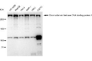 Western blotting analysis using Chromodomain helicase DNA binding protein 4 antibody (ABIN7800918).