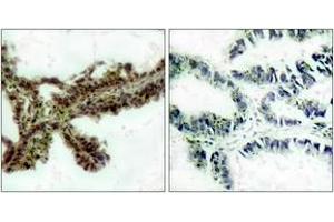 Immunohistochemistry (IHC) image for anti-V-Akt Murine Thymoma Viral Oncogene Homolog 1/2 (AKT1/2) (pThr308) antibody (ABIN2888353) (AKT1/2 anticorps  (pThr308))