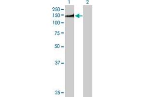 Western Blot analysis of NUMA1 expression in transfected 293T cell line by NUMA1 MaxPab polyclonal antibody.