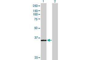 Western Blot analysis of POLK expression in transfected 293T cell line by POLK MaxPab polyclonal antibody. (POLK anticorps  (AA 1-472))