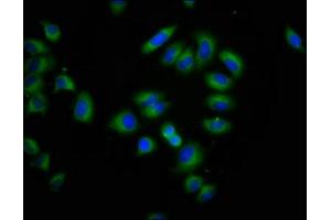 Immunofluorescence staining of A549 cells with ABIN7147931 at 1:266, counter-stained with DAPI.