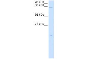 WB Suggested Anti-RARRES3 Antibody Titration:  5. (RARRES3 anticorps  (Middle Region))