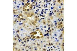 Immunohistochemical analysis of EPHX2 staining in rat kidney formalin fixed paraffin embedded tissue section.