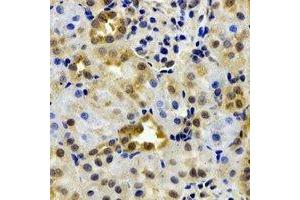 Immunohistochemical analysis of EPHX2 staining in rat kidney formalin fixed paraffin embedded tissue section. (EPHX2 anticorps)