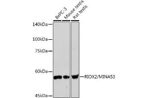 Western blot analysis of extracts of various cell lines, using RIOX2/RIOX2/MIN Rabbit mAb (ABIN7269991) at 1:1000 dilution. (RIOX2 anticorps)