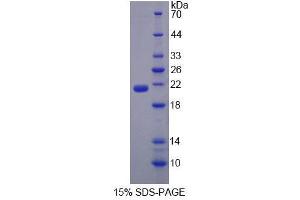 SDS-PAGE analysis of Mouse EPRS Protein. (EPRS Protéine)