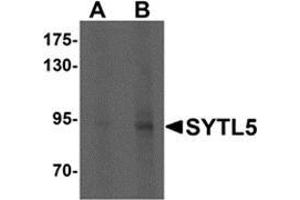 Western blot analysis of SYTL5 in Hela cell lysate with SYTL5 antibody at (A) 1 and (B) 2 μg/ml. (SYTL5 anticorps  (N-Term))