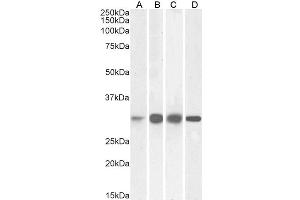 ABIN5539547 (0. (Ketohexokinase anticorps  (Internal Region))