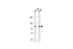 All lanes : Anti-NAT10 Antibody (N-Term) at 1:2000 dilution Lane 1: Human lung lysate Lane 2: Hela whole cell lysate Lysates/proteins at 20 μg per lane. (NAT10 anticorps  (AA 146-178))
