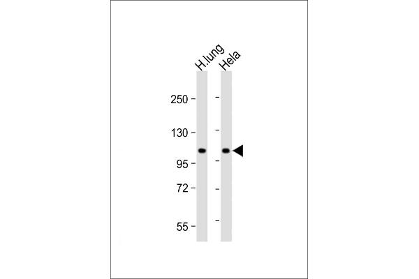 NAT10 anticorps  (AA 146-178)
