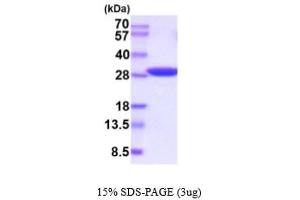 Triosephosphate Isomerase 1 (TPI1) (AA 1-249) (Active) protein (His tag)