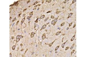 Immunohistochemistry of paraffin-embedded Mouse brain using RPS14 Polyclonal Antibody at dilution of 1:100 (40x lens). (RPS14 anticorps)