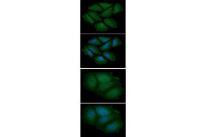 ICC/IF analysis of CNBP in HeLa cells line, stained with DAPI (Blue) for nucleus staining and monoclonal anti-human CNBP antibody (1:100) with goat anti-mouse IgG-Alexa fluor 488 conjugate (Green).