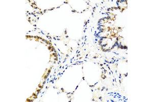 Immunohistochemistry of paraffin-embedded rat lung using IL13 antibody at dilution of 1:100 (40x lens). (IL-13 anticorps)