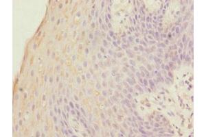 Immunohistochemistry of paraffin-embedded human tonsil tissue using ABIN7153088 at dilution of 1:100 (FOXP1 anticorps  (AA 1-114))
