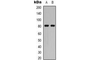 Western blot analysis of Caldesmon (pS789) expression in HEK293T PMA-treated (A), NIH3T3 (B) whole cell lysates. (Caldesmon anticorps  (C-Term, pSer789))