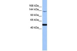 WB Suggested Anti-MAP3K1 Antibody Titration:  0. (MAP3K1 anticorps  (C-Term))