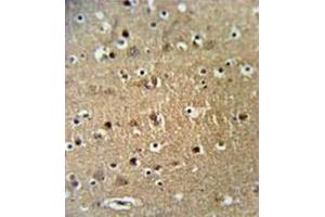 anti-Striatin Interacting Protein 1 (STRIP1) (AA 359-389), (Middle Region) antibody