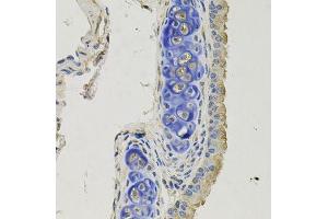 Immunohistochemistry of paraffin-embedded mouse lung using GPHN antibody. (Gephyrin anticorps  (AA 520-769))