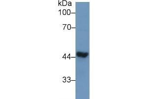 Detection of TDP43 in Human Liver lysate using Polyclonal Antibody to Tar DNA Binding Protein 43 kDa (TDP43)