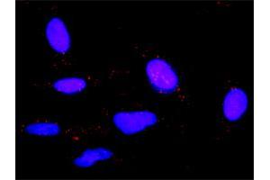 Proximity Ligation Analysis of protein-protein interactions between IL6 and HRH1.