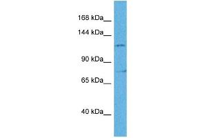 Host:  Rabbit  Target Name:  ZEB2  Sample Tissue:  Human HCT116 Whole Cell  Antibody Dilution:  1ug/ml