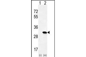 Western blot analysis of HRAS (arrow) using rabbit polyclonal HRAS Antibody (C-term) (ABIN655622 and ABIN2845102). (HRAS anticorps  (C-Term))