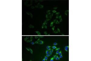 Immunofluorescence analysis of HeLa cells using AK1 Polyclonal Antibody (Adenylate Kinase 1 anticorps)