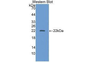 Western blot analysis of recombinant Human AAP. (ALT anticorps  (AA 581-738))