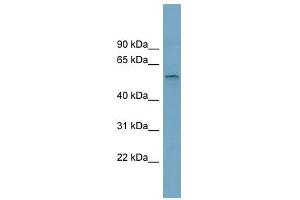 SLC22A15 antibody used at 1 ug/ml to detect target protein. (SLC22A15 anticorps  (Middle Region))
