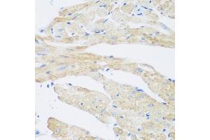 Immunohistochemistry of paraffin-embedded mouse heart using NB antibody (ABIN6132989, ABIN6144383, ABIN6144385 and ABIN6223030) at dilution of 1:200 (40x lens). (NAT8B anticorps  (AA 75-165))