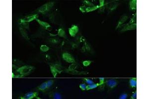 Immunofluorescence analysis of U2OS cells using CXCR5 Polyclonal Antibody at dilution of 1:100. (CXCR5 anticorps)