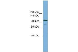 WB Suggested Anti-Hira Antibody Titration:  0. (HIRA anticorps  (Middle Region))
