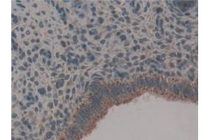 Detection of Hsp60 in Mouse Uterus Tissue using Polyclonal Antibody to Heat Shock Protein 60 (Hsp60)