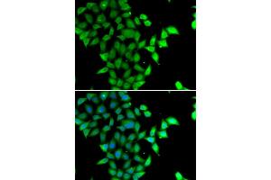 Immunofluorescence analysis of U20S cell using STAM2 antibody. (STAM2 anticorps)