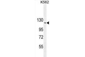 Western Blotting (WB) image for anti-rho GTPase Activating Protein 17 (ARHGAP17) antibody (ABIN2995824) (ARHGAP17 anticorps)