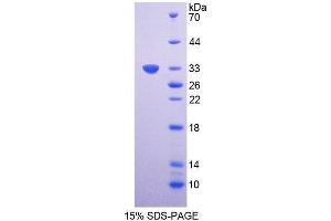 SDS-PAGE (SDS) image for Cyclin-Dependent Kinase 4 (CDK4) (AA 6-295) protein (His tag) (ABIN1878455)