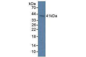 Detection of OAS1 in Rat Stomach Tissue using Polyclonal Antibody to 2',5'-Oligoadenylate Synthetase 1 (OAS1) (OAS1 anticorps  (AA 139-358))